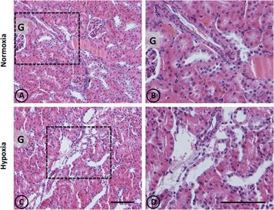 Imbalance in Renal Vasoactive Enzymes Induced by Mild Hypoxia: Angiotensin-Converting Enzyme Increases While Neutral Endopeptidase Decreases